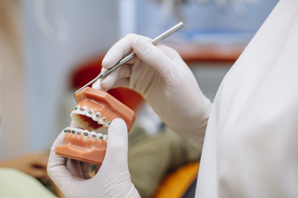Atliekant ortodontinį gydymą